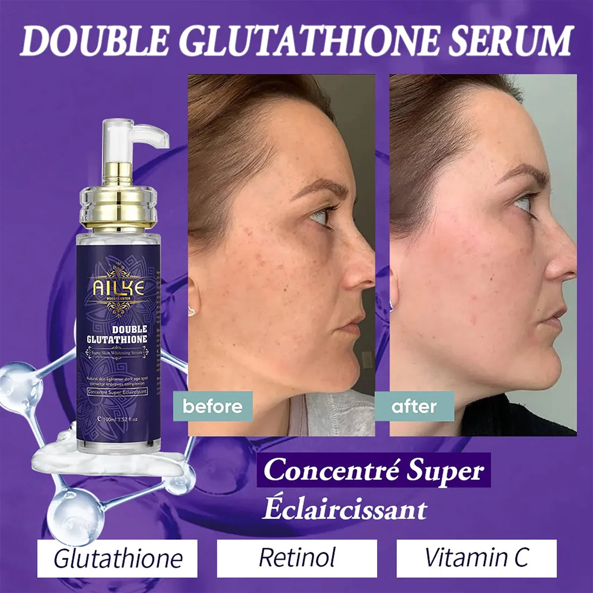 AILKE Glutathione Whitening Essence Moisturizing Serum For Even Tone