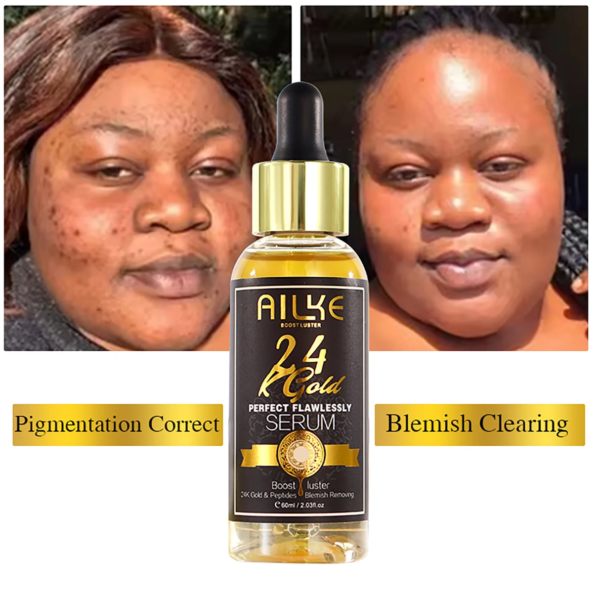 Ailke Brightening Skin Care Set With Vitamin C Moisturizer