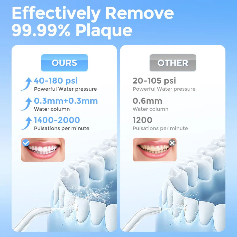 Sejoy Portable Cordless Water Flosser With Six Jet Modes